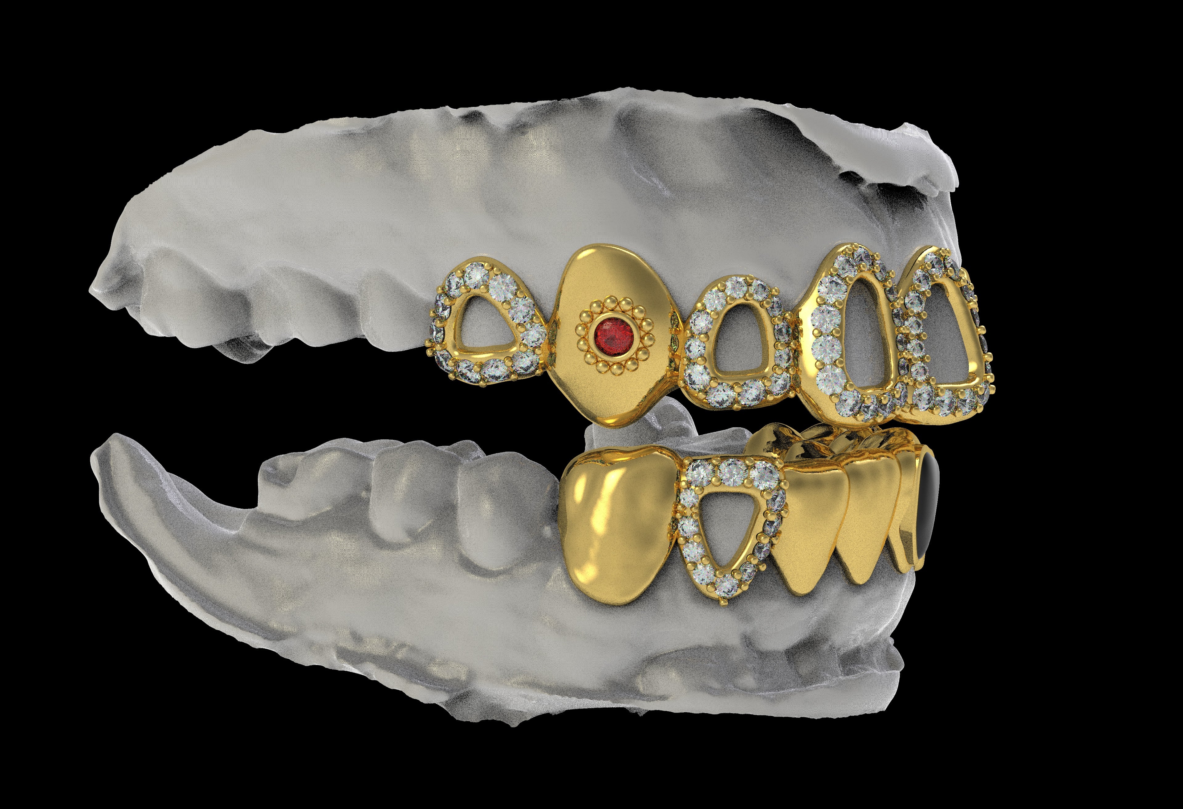 Custom Top/Bottom 8 14K Gold Grillz - For Leo