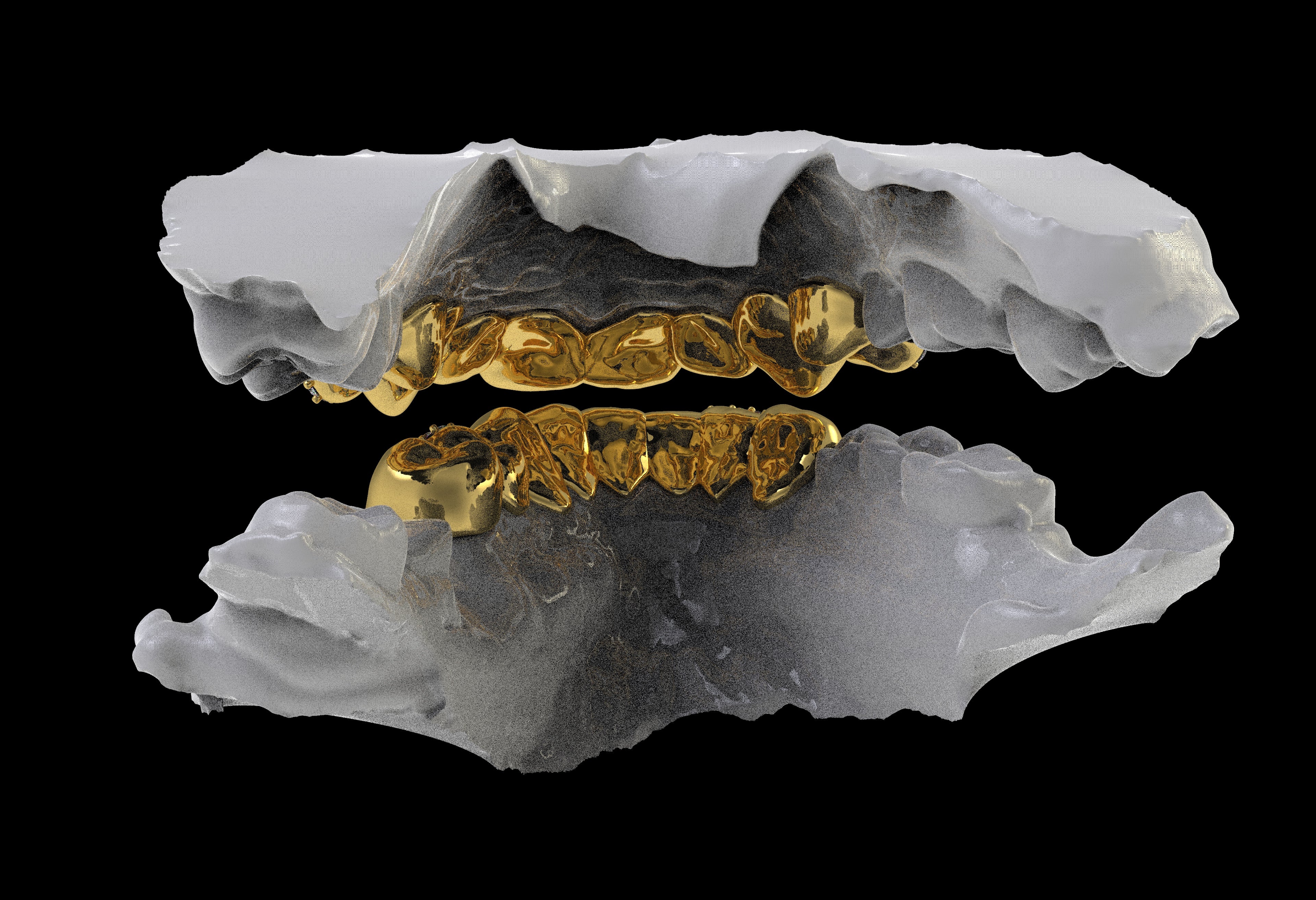 Custom Top/Bottom 8 14K Gold Grillz - For Leo