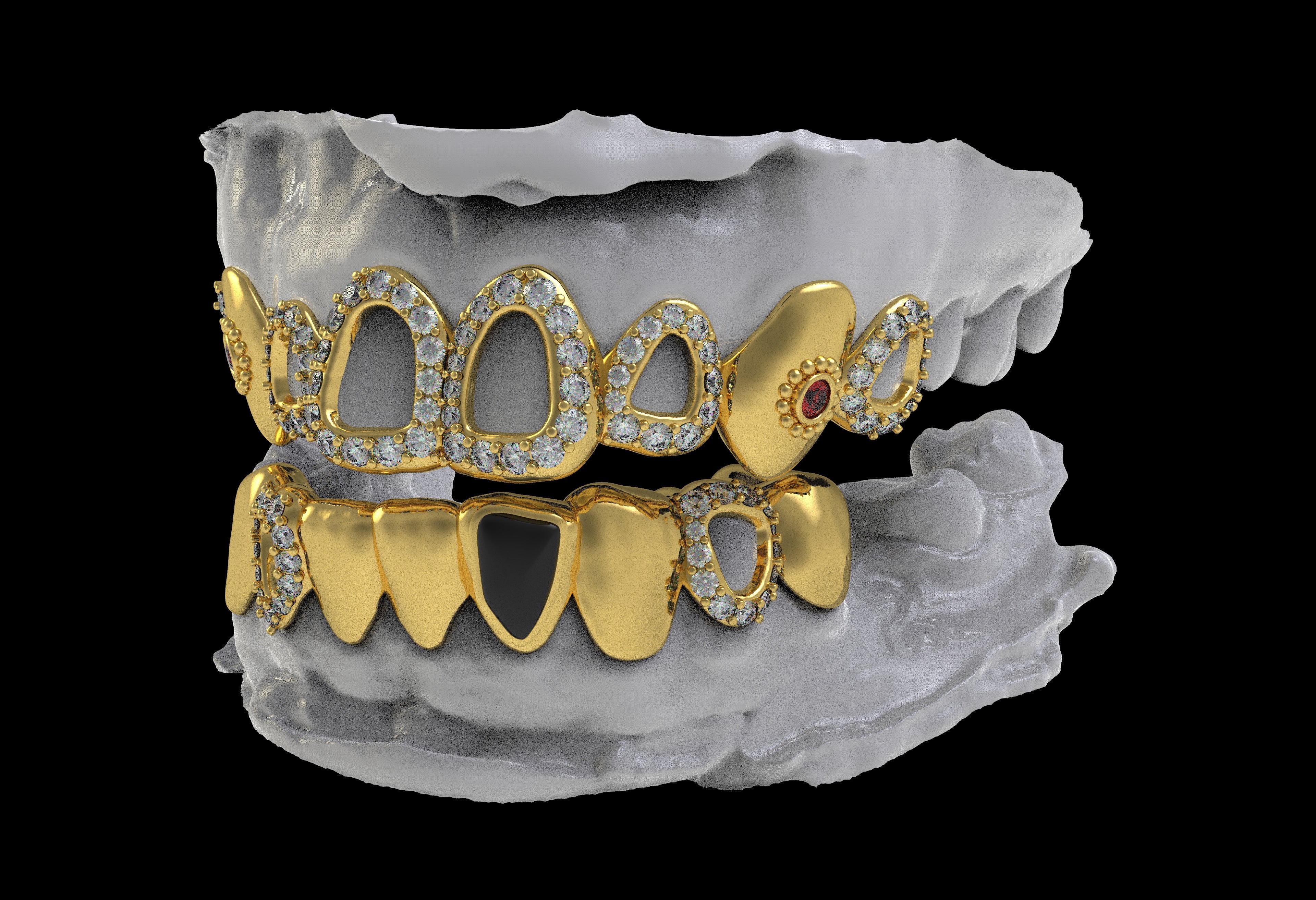 Custom Top/Bottom 8 14K Gold Grillz - For Leo