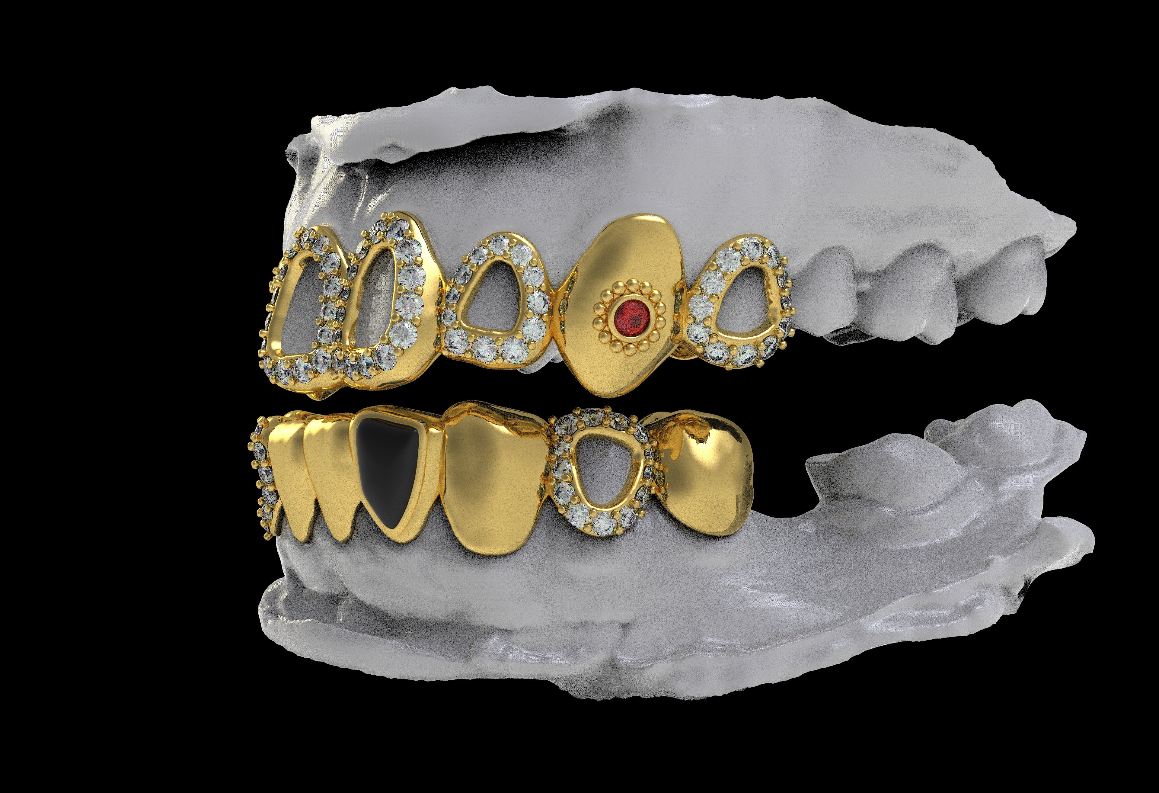 Custom Top/Bottom 8 14K Gold Grillz - For Leo
